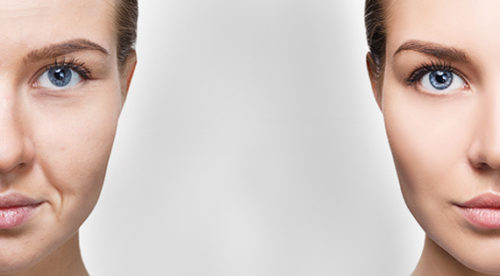 Buinewicz Cosmetic Surgery & Medspa - Before & After