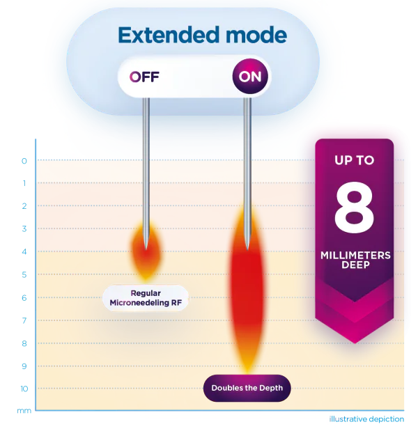 Illustrated diagram comparing standard and extended-depth microneedling RF modes