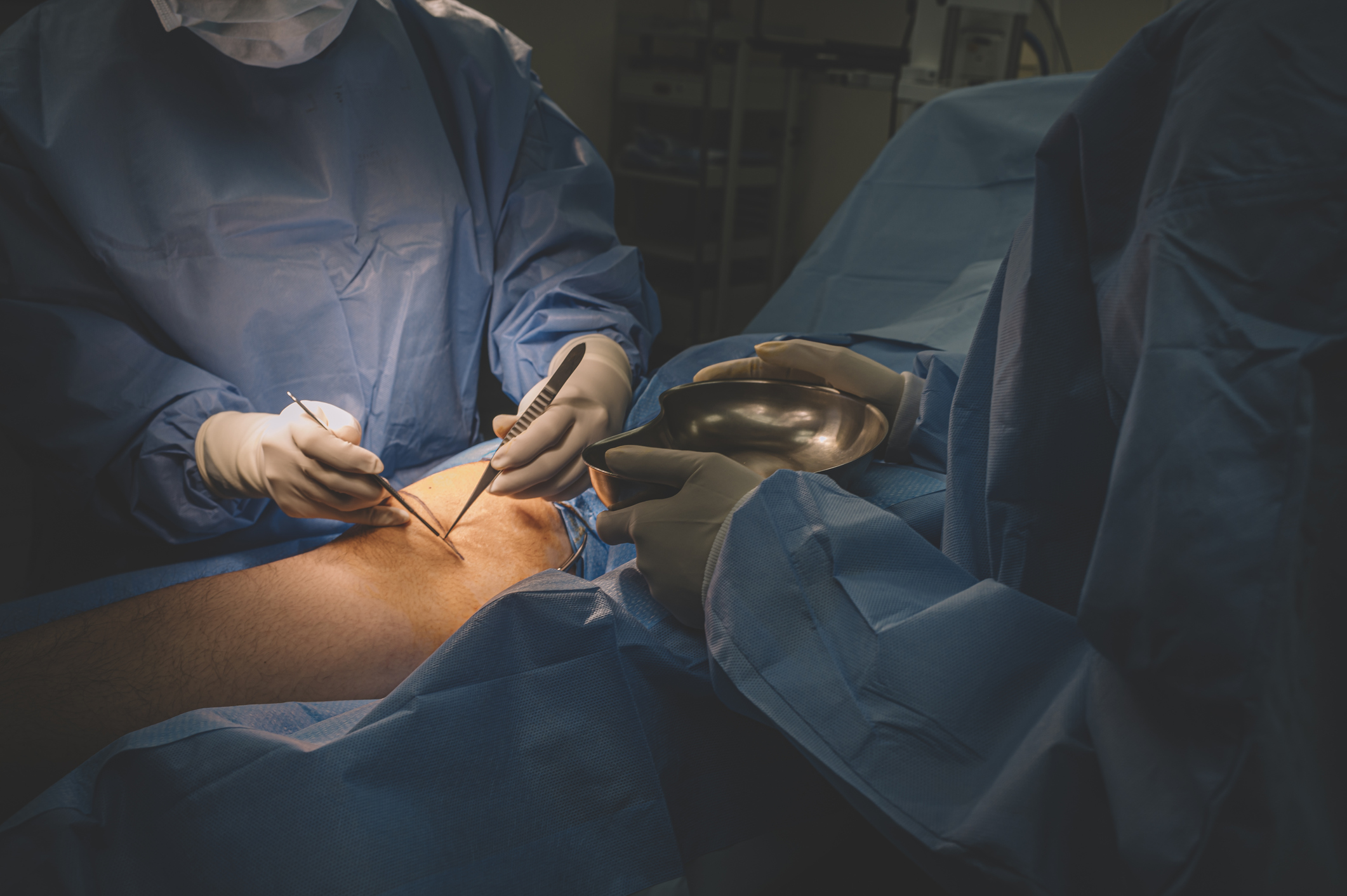 a group of surgeon and nurses operating on a chinese male patient's leg in operating room