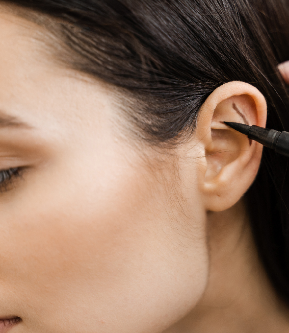 Marker line drawn on a woman's ear before a procedure