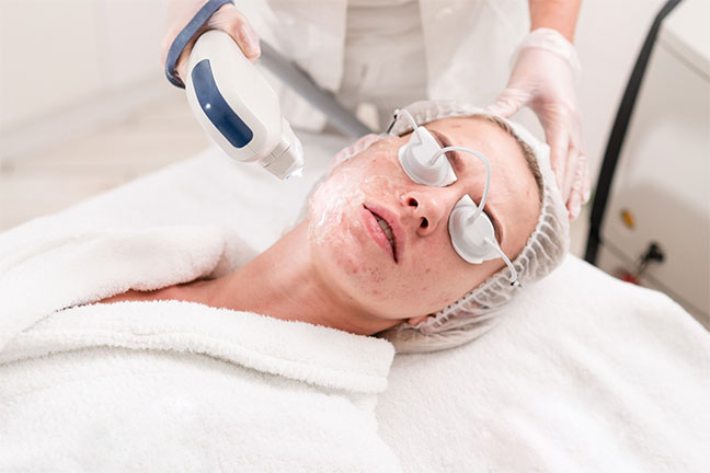 Esthetician performing a laser facial treatment on a client