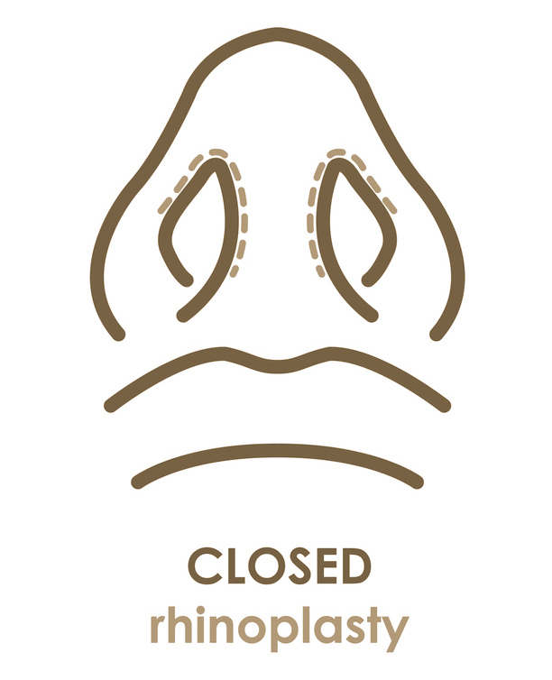 closed