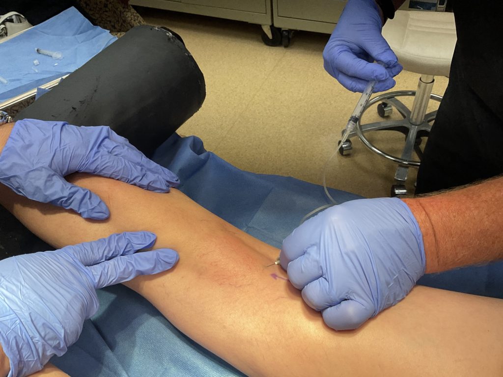 Varicose Vein Treatment in Bucks County, PA, and Hunterdon County, NJ