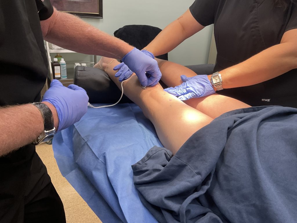 Varicose Vein Treatment in Bucks County, PA, and Hunterdon County, NJ