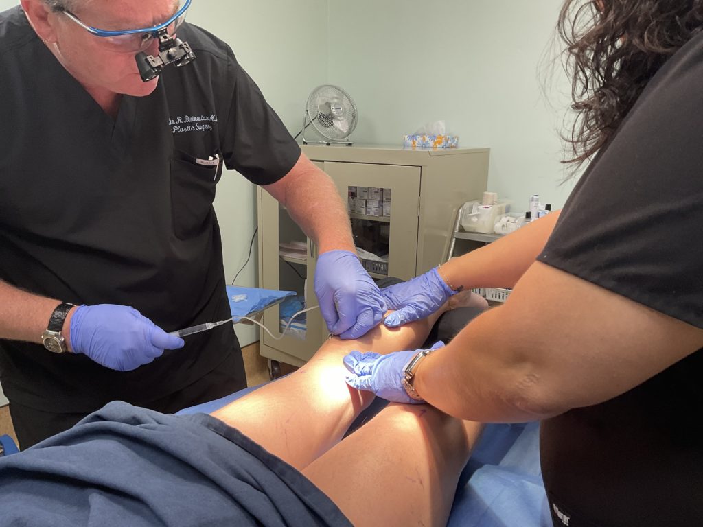Varicose Vein Treatment in Bucks County, PA, and Hunterdon County, NJ