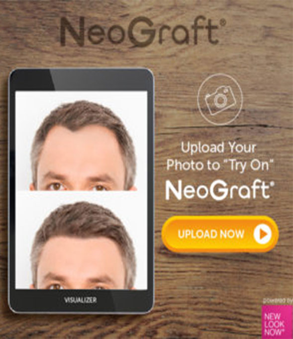 NeoGraft promotional banner for a hair-growth visualizer tool
