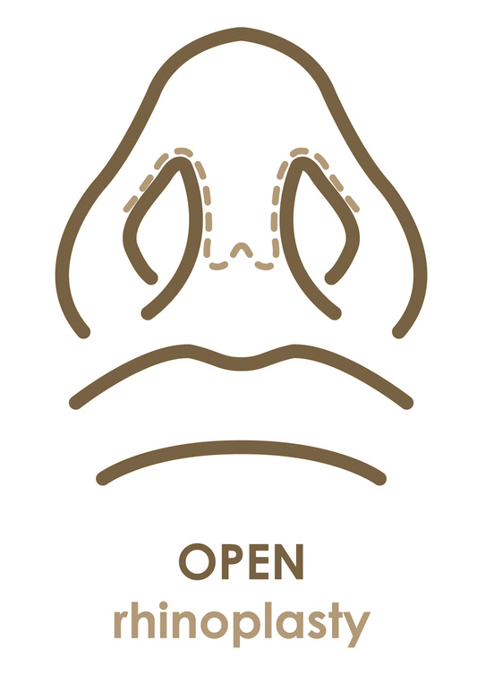 open
